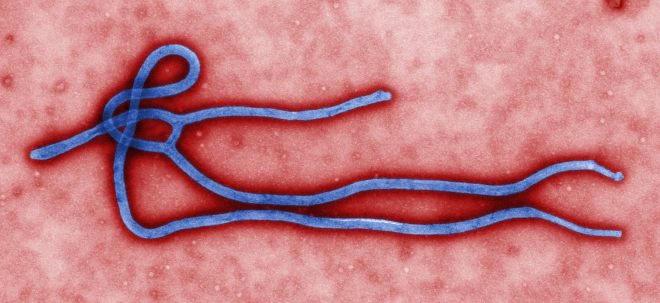 A colorized transmission electron micrograph (TEM) image of an  Ebola virus virion, created by CDC microbiologist Cynthia Goldsmith. Credit: CDC global Flickr stream.
